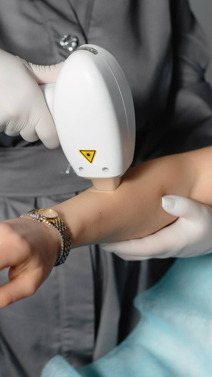 Person receiving laser hair removal treatment with a professional device.