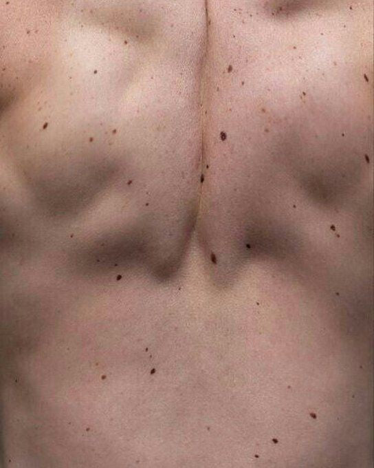 Close-up of a person's neck with visible skin texture.