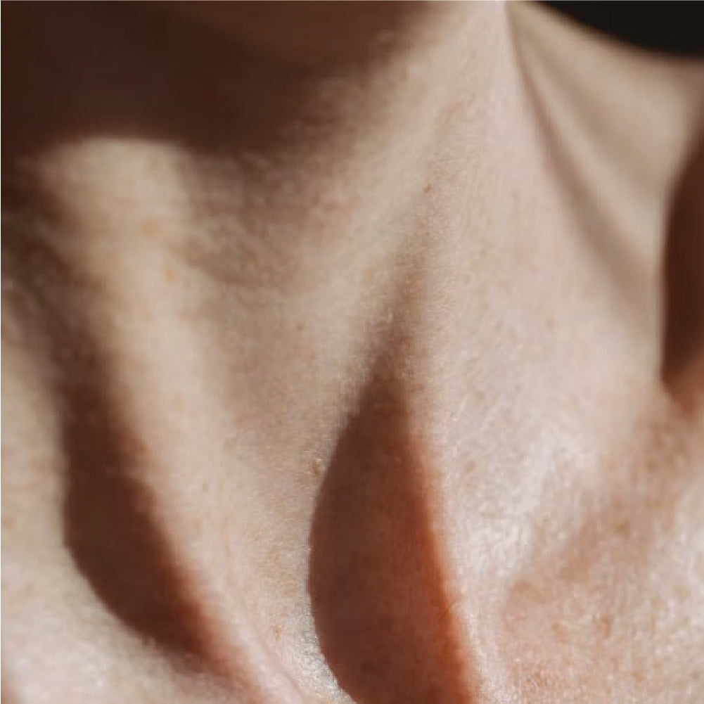 Concern -> All Skin