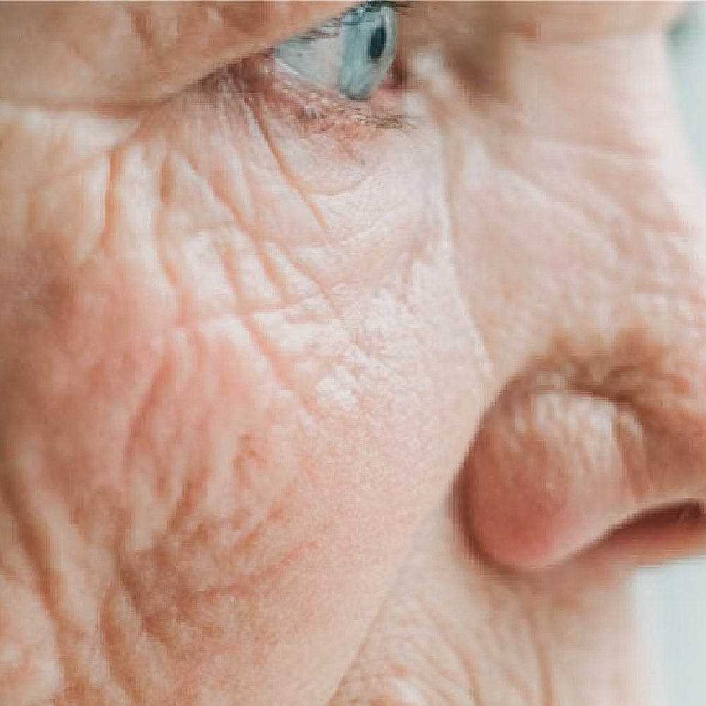 Concern -> Antiaging