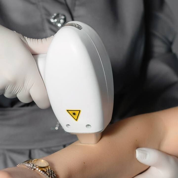Person receiving laser hair removal treatment with a professional device.