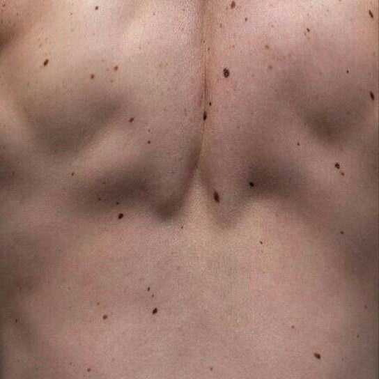 Close-up of a person's neck with visible skin texture.